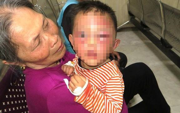 Không xử lý hình sự vụ bố dượng bạo hành bé trai 3 tuổi ảnh 1 Không xử lý hình sự vụ bố dượng bạo hành bé trai 3 tuổi ảnh 1