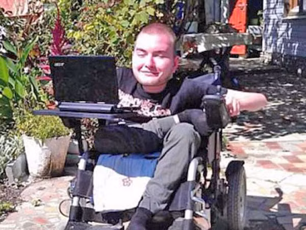 Người đầu tiên tình nguyện ghép đầu ảnh 1