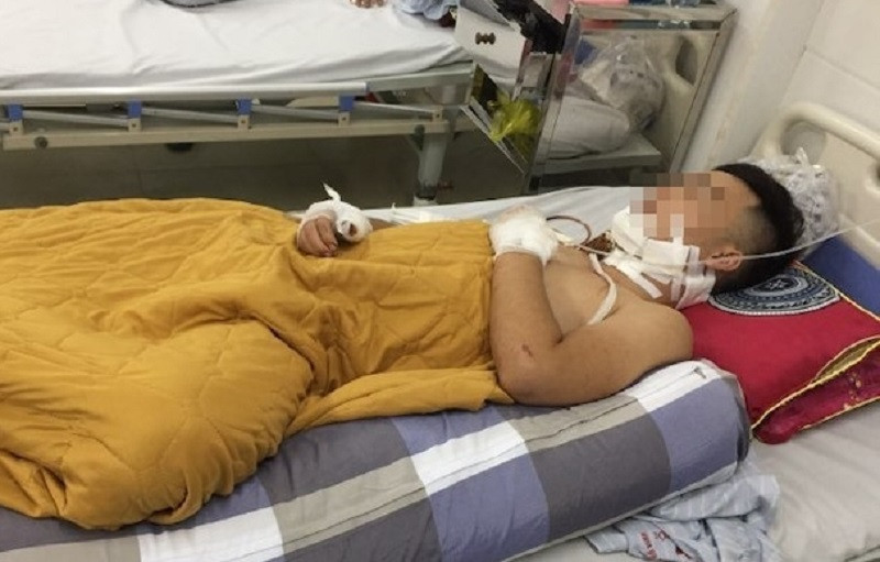 Mâu thuẫn tại quán ăn đêm, cầm kéo truy sát đối thủ trọng thương ảnh 1 Mâu thuẫn tại quán ăn đêm, cầm kéo truy sát đối thủ trọng thương ảnh 1