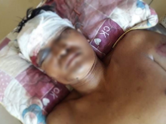 Người đàn ông bị "con nợ" đánh trọng thương ảnh 1 Người đàn ông bị "con nợ" đánh trọng thương ảnh 1