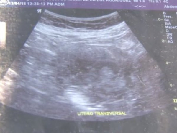 Mexico: Ngạc nhiên với cụ bà mang thai đứa con thứ 8 ở tuổi 70 ảnh 2