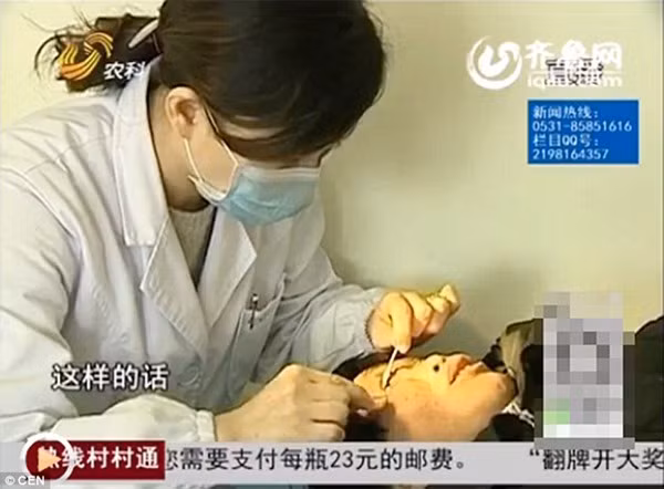 Người phụ nữ Trung Quốc khóc... ra đá to bằng hạt đậu tương ảnh 4