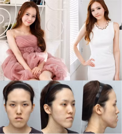 Choáng với tài "dao kéo" của ê kíp bác sĩ Let Me In vừa sang Việt Nam ảnh 6 Choáng với tài "dao kéo" của ê kíp bác sĩ Let Me In vừa sang Việt Nam ảnh 6