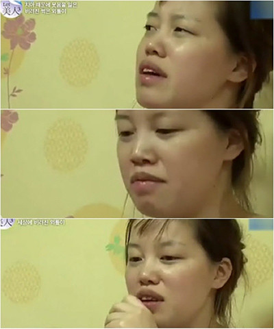 Choáng với tài "dao kéo" của ê kíp bác sĩ Let Me In vừa sang Việt Nam ảnh 3