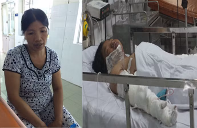 Xót xa hoàn cảnh của bé gái bị mẹ tẩm xăng đốt ảnh 1