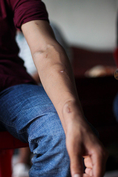 Người chị cả gánh vác trên vai cả một gia đình bệnh tật ảnh 3 Người chị cả gánh vác trên vai cả một gia đình bệnh tật ảnh 3