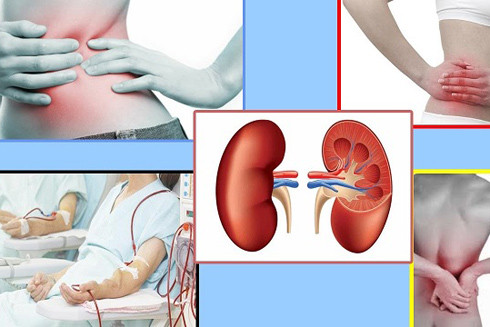 Chức năng thận suy yếu: Dấu hiệu không thể bỏ qua ảnh 1