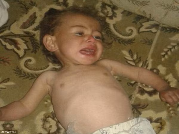 Nội chiến Syria: Trẻ em đang chết dần chết mòn vì đói ăn ảnh 1