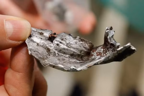 Rùng mình cảnh "bom đinh" tàn phá cơ thể nạn nhân vụ khủng bố ở Bỉ ảnh 9