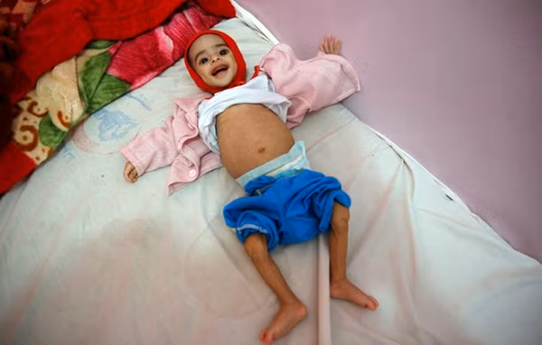 Cái chết ám ảnh của bé trai 5 tháng tuổi tố cáo tội ác chiến tranh ảnh 8