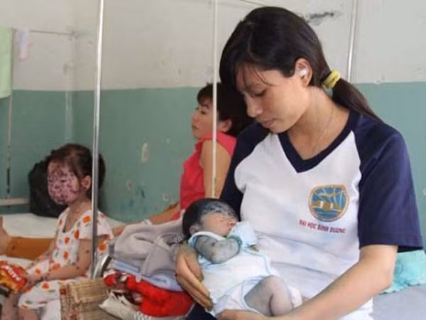 Cảnh giác bệnh truyền nhiễm trong mùa Đông Xuân ảnh 1