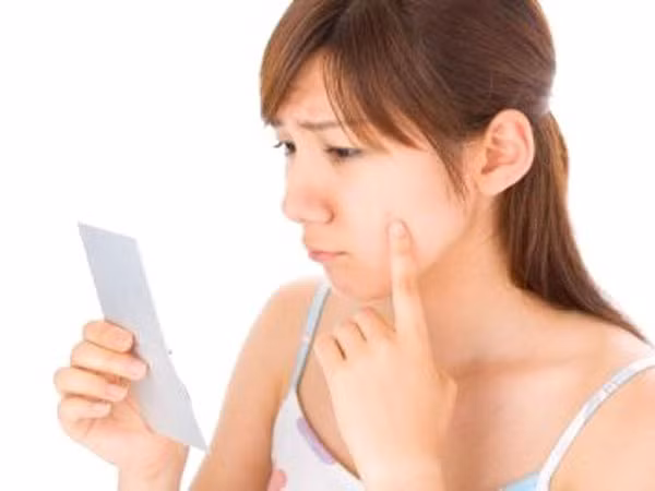 Cách đơn giản để ngăn ngừa mụn ảnh 1