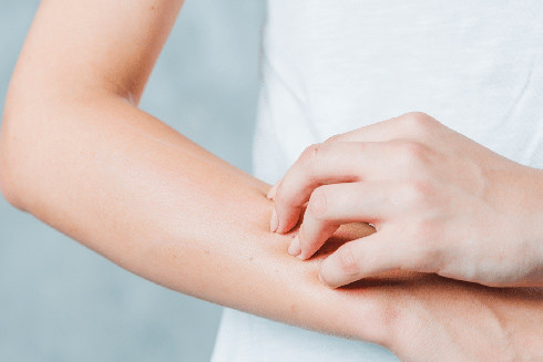 Dị ứng thời tiết: Biểu hiện và những nguy hiểm đối với cơ thể ảnh 1