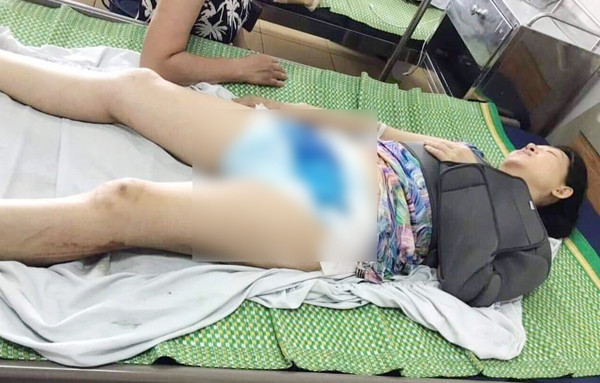 Xác minh thông tin chồng dùng ô tô đâm, khiến vợ cũ bị đa chấn thương ảnh 1