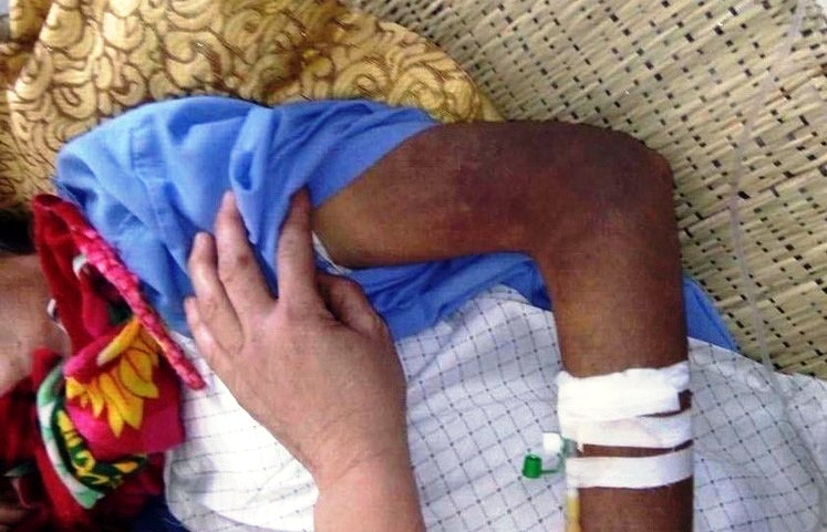 Cuộc sống cơ cực của người đàn ông bị con trai đánh đập nhập viện ảnh 1