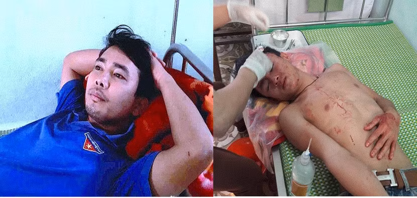 Sở GD&ĐT Nghệ An yêu cầu làm rõ sự việc thầy giáo và học sinh bị đánh ngay tại trường học ảnh 1 Sở GD&ĐT Nghệ An yêu cầu làm rõ sự việc thầy giáo và học sinh bị đánh ngay tại trường học ảnh 1