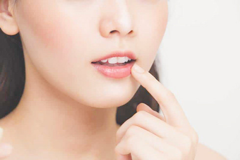 10 dấu hiệu liên quan đến sức khỏe từ thay đổi bất thường trên đôi môi ảnh 1