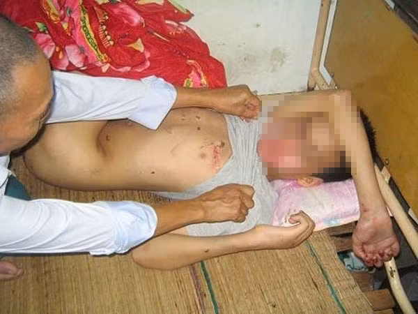 Trẻ em nam - nạn nhân mới của tội phạm xâm hại tình dục: Nạn nhân không chỉ là bé gái ảnh 2