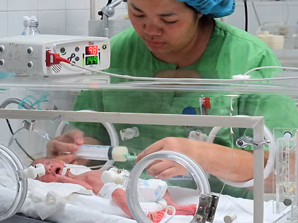 Trẻ sinh non gia tăng - Đối mặt nhiều nguy cơ ảnh 1
