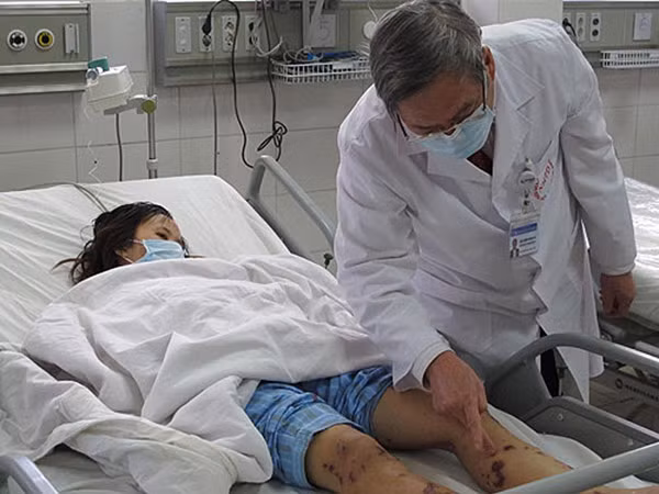 Gia tăng bệnh viêm màng não mô cầu ảnh 1