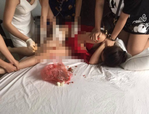 Vụ đánh ghen dã man ở Bình Xuyên: Nạn nhân cần làm đơn tố cáo để tìm lại công bằng ảnh 3