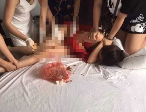 Vụ đánh ghen dã man ở Bình Xuyên: Nạn nhân cần làm đơn tố cáo để tìm lại công bằng ảnh 3