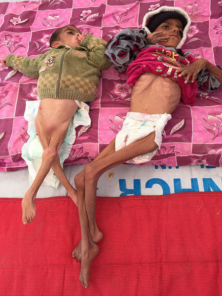 Nghẹn lòng trước số phận những em bé ở Mosul, Iraq ảnh 2