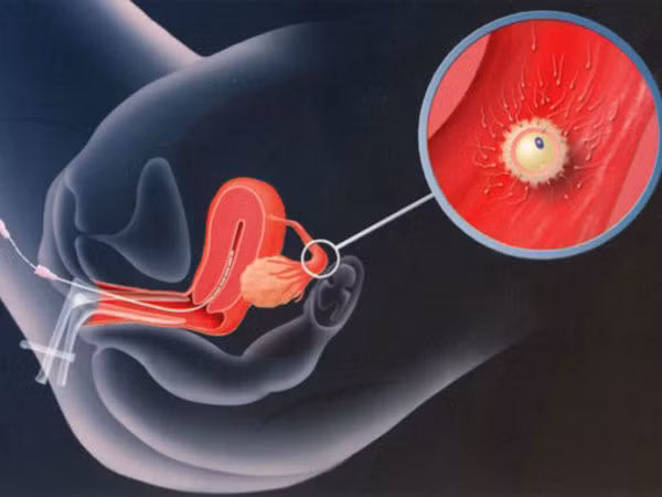 Sản xuất tinh trùng trong ống nghiệm ảnh 1