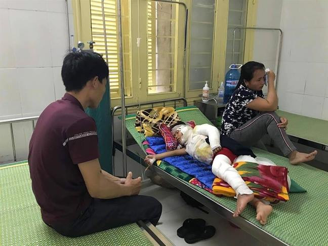 Dùng xăng nhóm bếp nấu cơm, nam sinh bị bỏng nặng ảnh 1