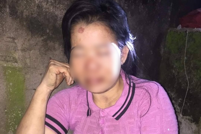 Làm rõ nghi vấn người phụ nữ bị hành hung dã man ảnh 1