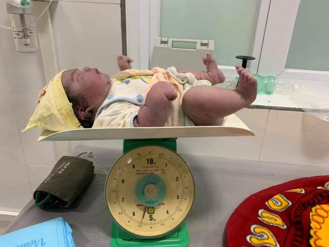 Hi hữu: Sản phụ 33 tuổi sinh thường bé gái nặng 5,5kg ảnh 1
