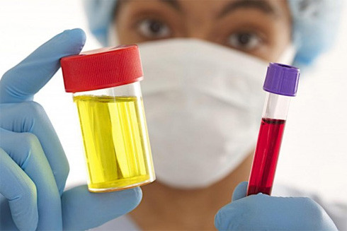 Tiểu ra máu: Dấu hiệu của bệnh gì? ảnh 1 Tiểu ra máu: Dấu hiệu của bệnh gì? ảnh 1