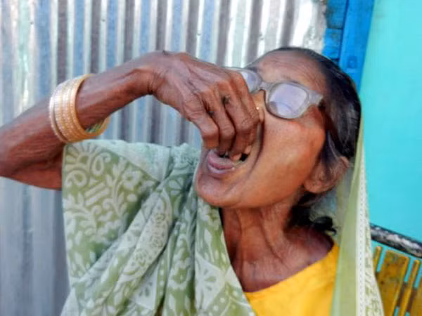 Gặp cụ già nghiện ăn 3-4 bát cát, sỏi mỗi ngày ảnh 1