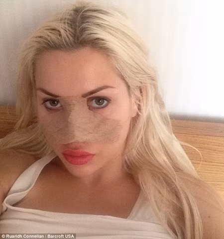 Cô gái cắt phăng 6 xương sườn để có vòng eo con kiến 35cm ảnh 4