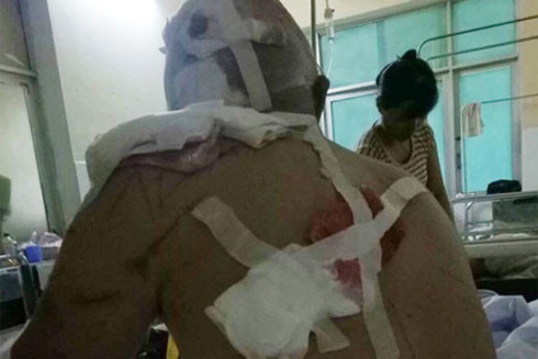 Một thanh niên bị chém gục tại nương sắn ảnh 1