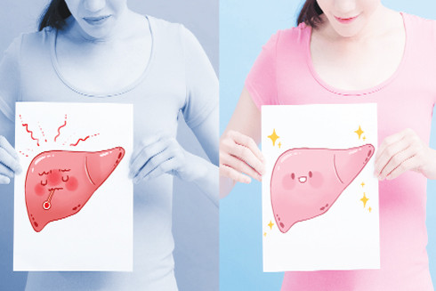 Cách nhận biết bệnh gan qua sự thay đổi sắc tố của làn da ảnh 1 Cách nhận biết bệnh gan qua sự thay đổi sắc tố của làn da ảnh 1