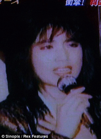 Tự tiêm dầu ăn, mặt người mẫu biến dạng đang sợ ảnh 4