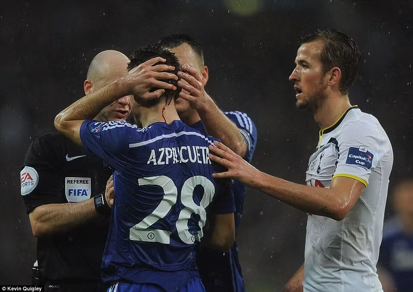 Đổ mồ hôi và máu, Chelsea giành cúp Liên đoàn ảnh 4