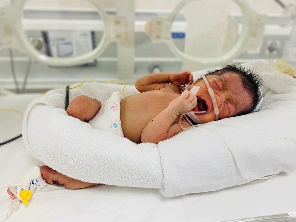 Bé sinh non bị bỏ rơi bên đường, tính mạng nguy kịch được bác sĩ cứu sống ảnh 1