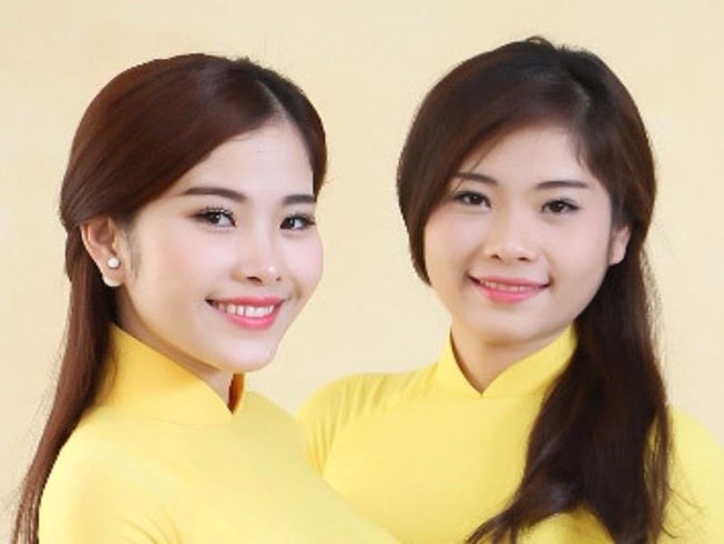 Loạt ảnh "tố" Nam Em rõ ràng đẹp lên nhờ "dao kéo" ảnh 9 Loạt ảnh "tố" Nam Em rõ ràng đẹp lên nhờ "dao kéo" ảnh 9