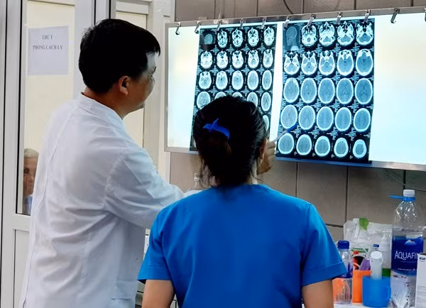 Một thanh niên xuất huyết não sau khi sử dụng ma túy đá ảnh 1