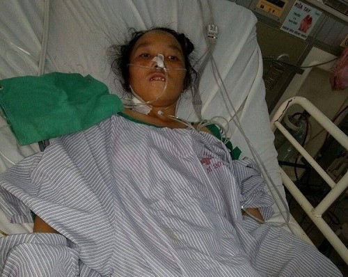 Nữ bệnh nhân có 40 con giun trong ống mật chủ ảnh 1