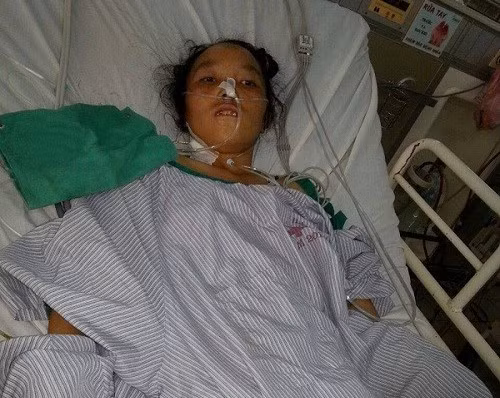 Nữ bệnh nhân có 40 con giun trong ống mật chủ ảnh 1