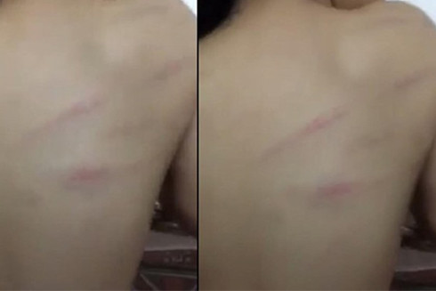 Những vụ giáo viên hành xử dị thường, phạt học trò theo kiểu "không thể nghĩ ra" ảnh 3