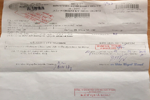 Nhiễm ấu trùng sán lợn: Nguy hiểm khôn lường ảnh 1