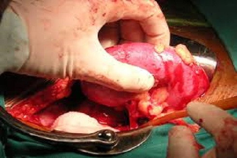 Hành vi buôn bán nội tạng người bị xử lý thế nào? ảnh 1