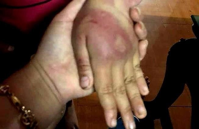 [Audio 21-5-2019] Đánh bầm dập con gái 8 tuổi, người bố bị phạt 2,5 triệu đồng ảnh 3