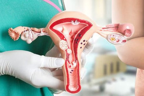 Nguyên nhân và yếu tố gây nguy cơ ung thư cổ tử cung cho phụ nữ ảnh 3