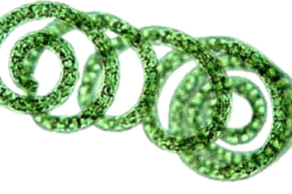 3 loài cây quý giúp phòng ngừa biến chứng tiểu đường không phải ai cũng biết ảnh 3