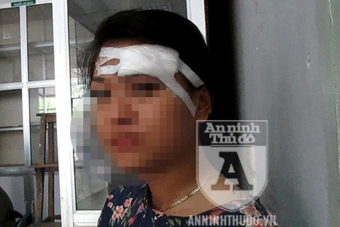 Tự vệ thế nào khi gặp những thanh niên biến chất giở trò "sàm sỡ" không thành quay ra hành hung kiểu côn đồ? ảnh 1